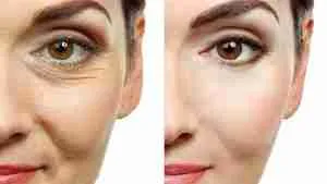 كريم Anti-Aging دعم شباب البشرة وتقليل مظهر الخطوط – 50 مل من غام