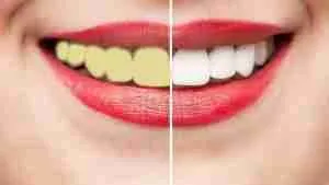 PROCSIN Hello Smile